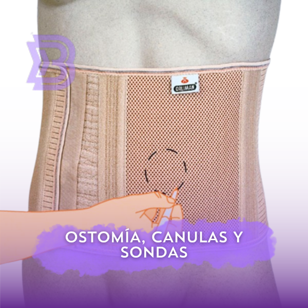 Ostomía, cánulas y sondas