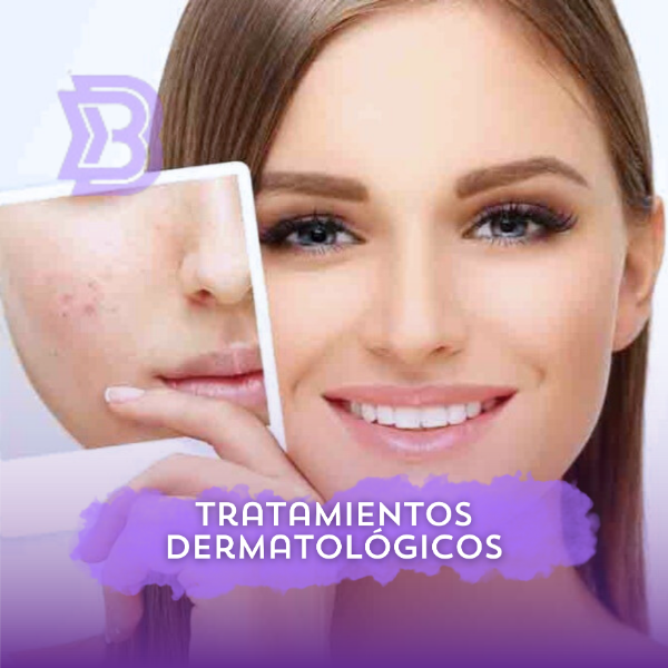 Tratamientos Dermatológicos